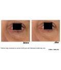 Réparation Vernal soins Eye Gel - Enlève les cernes sous les yeux, les yeux gonflés, ridules, pattes d'oie, rides, les poches | 