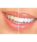 Smilebriter de blanchiment des dents Gel Pens 60 Day Supply