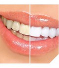 Numéro 1 Dr. Noté Meilleur professionnel des dents de sourire Brilliant blanchissant At Home Kit. Bonus Teeth gratuit Whitener P